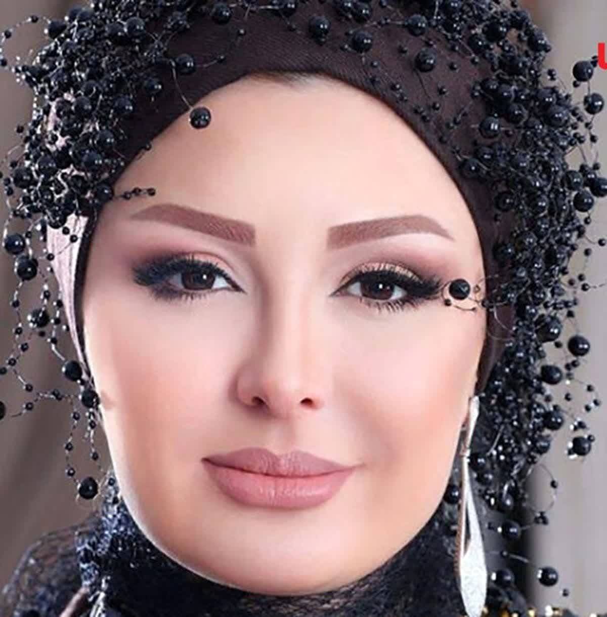 نیوشا ضیغمی در اتاق عمل برای جراحی زیبایی + فیلم