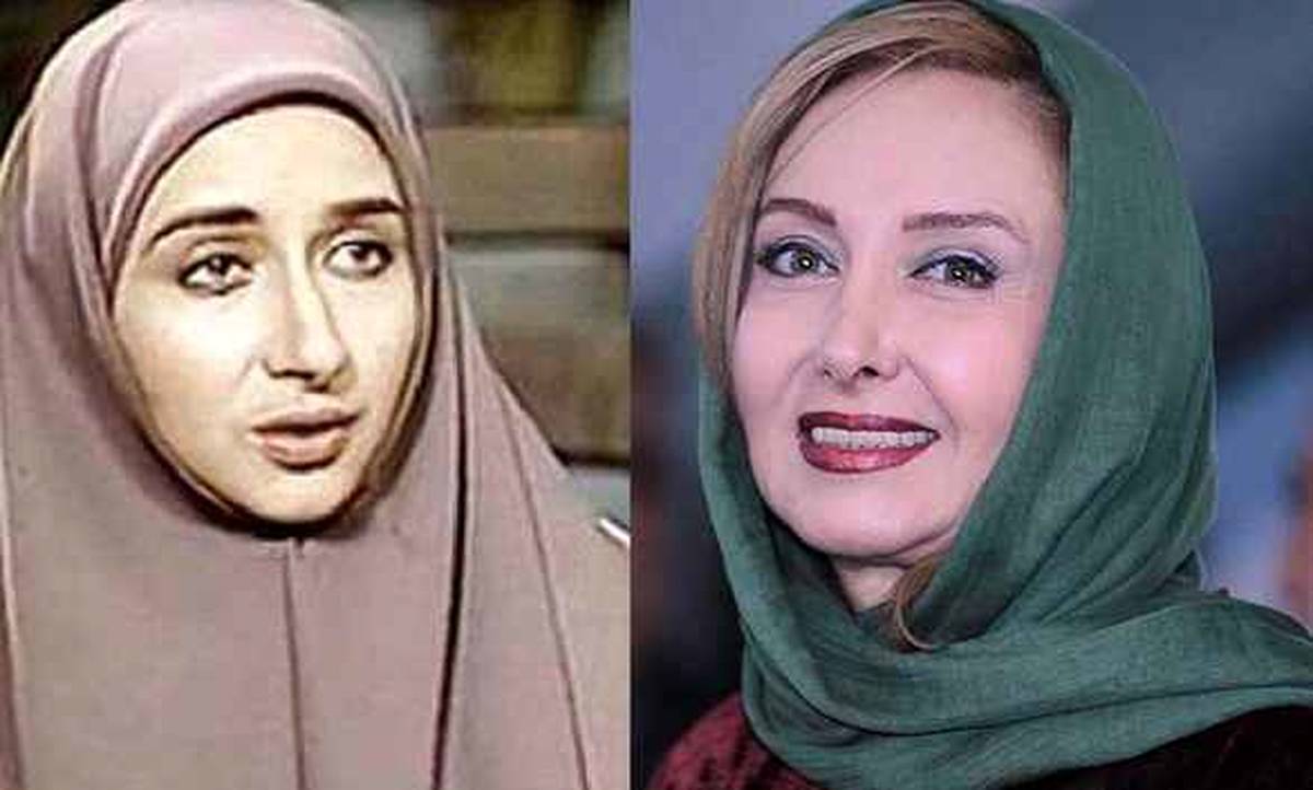 عکس قبل از عمل زیبایی کتایون ریاحی لو رفت | دماغ بزرگ کتایون ریاحی آسوژه ریاحی شد