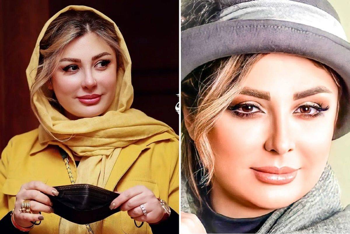صورت نیوشا ضیغمی بخیه لازم شد | زخم خونی نیوشا ضیغمی روی صورتش غوغا کرد